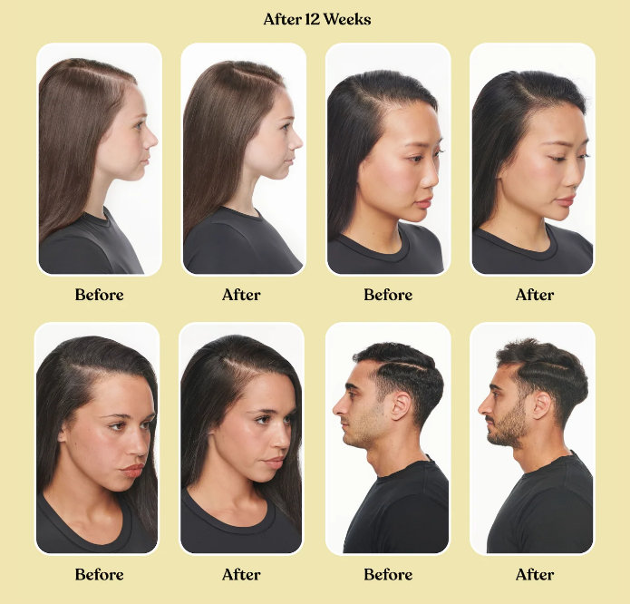 LEMME GROW® — CÁPSULAS PARA EL CRECIMIENTO Y ANTI-CAÍDA DEL CABELLO