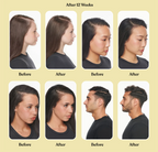 LEMME GROW® — CÁPSULAS PARA EL CRECIMIENTO Y ANTI-CAÍDA DEL CABELLO